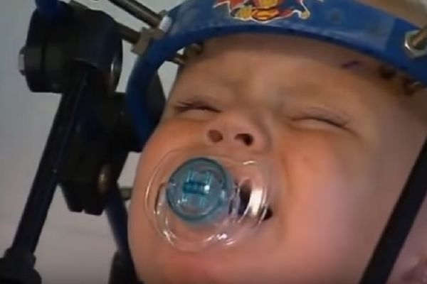 Lekari uspeli da nameste otkinutu glavu bebe posle strašne saobraćajne nesreće! (FOTO) (VIDEO)