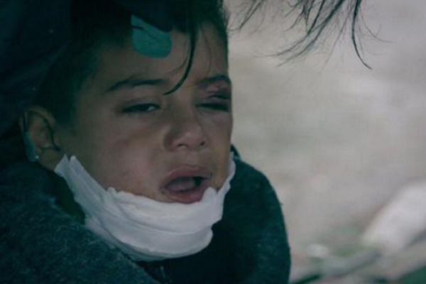 Pronađen petogodišnji Azam: Sirijac sa polomljenom vilicom sada je na sigurnom! (FOTO)