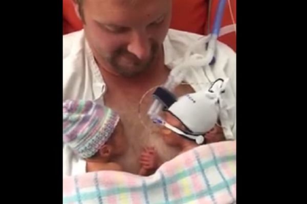 Rodili su se 11 nedelja ranije. I dalje ih je nemoguće razdvojiti! (VIDEO)