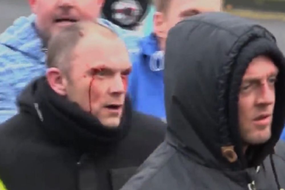 Makljaža fašista i antifašista u Engleskoj! Nije za one sa slabim želucem (VIDEO)