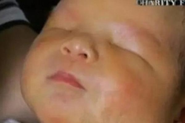 Rodio se dečak bez očiju, majka skrhana bolom! (VIDEO)
