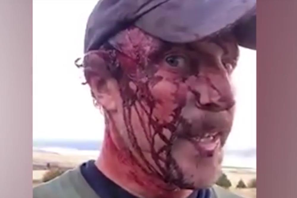 Postavio snimak na Fejs odmah nakon napada grizlija: Šokiraće vas kada vidite šta mu se desilo! (VIDEO)