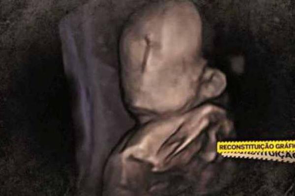 ROĐENA BEBA BEZ LICA: Nije imala ni oči i nos! Brzo je otkrivena UŽASNA ISTINA o LEKARU koji je vodio trudnoću!
