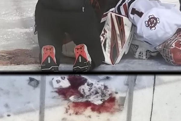 HOROR NA LEDU: Hokejaški golman isečen klizaljkom - samo je pao i ostao da leži u lokvi krvi!