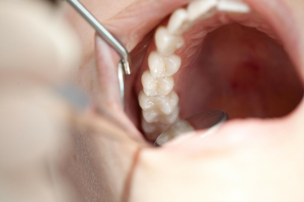 Šta sve zubar može da vidi kada dođete na pregled